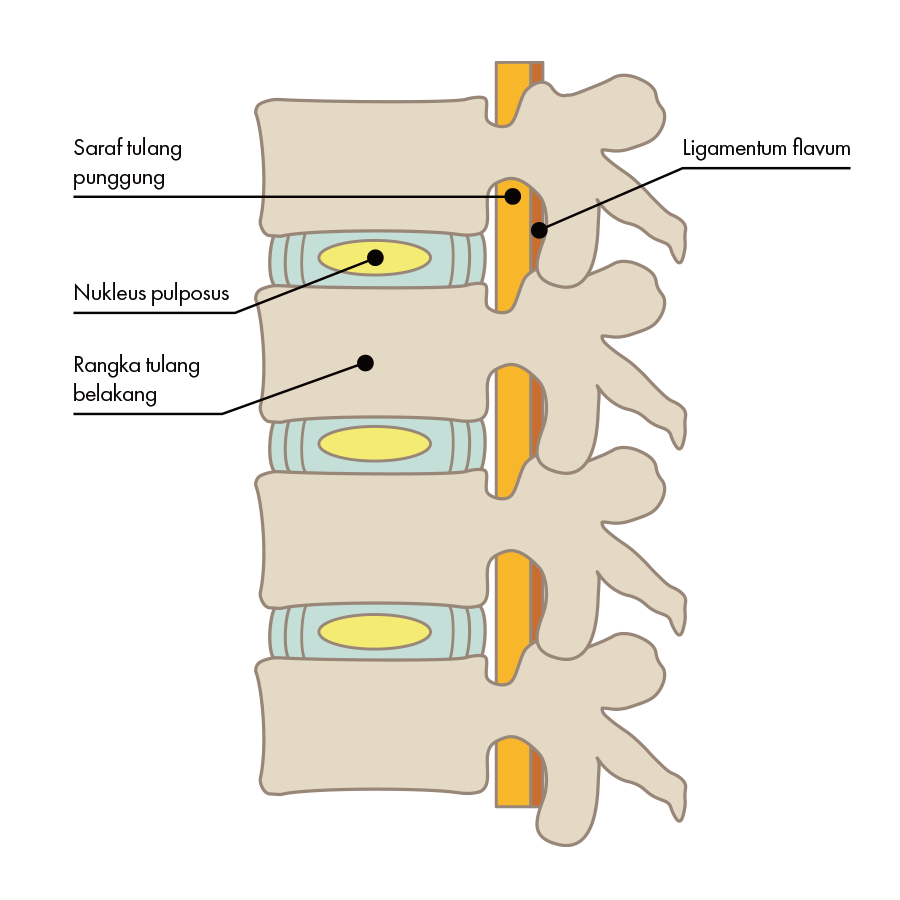 Diskus intervertebralis normal(sisi)