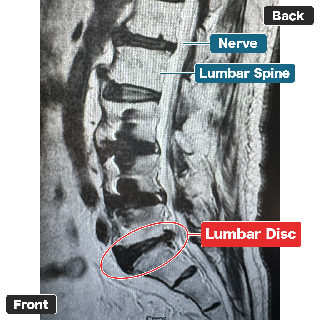 MRI Sebelum Perawatan