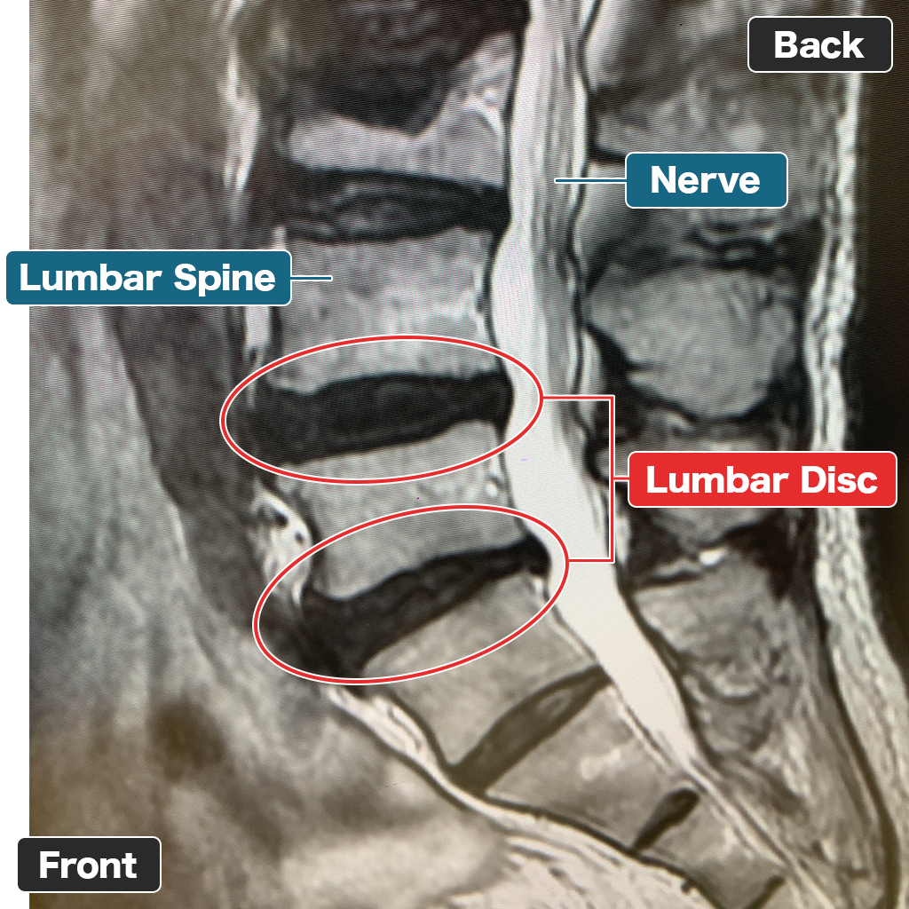 Foto MRI Setelah Perawatan