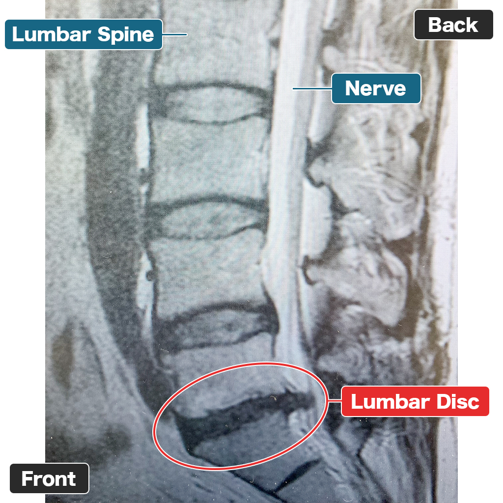 MRI Sebelum Perawatan