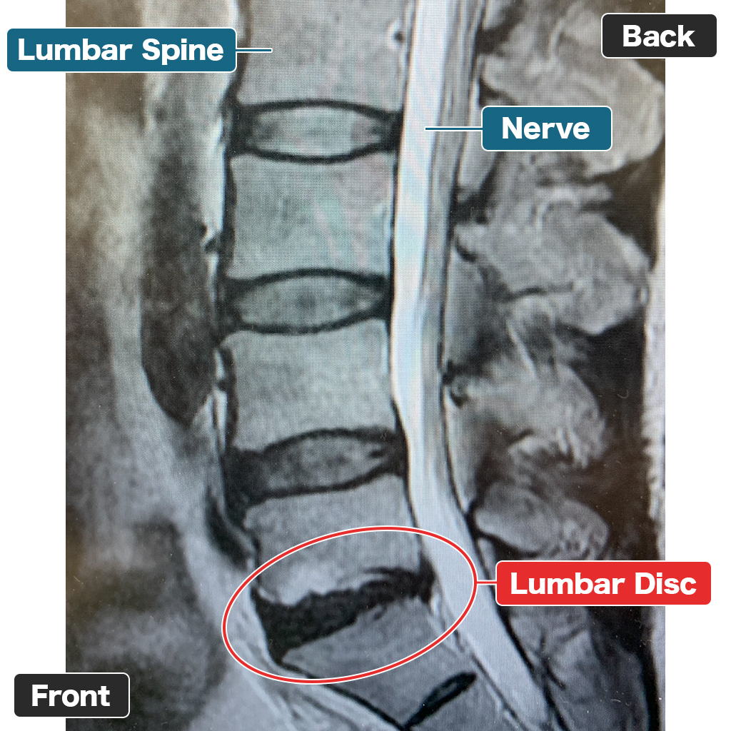 MRI Setelah Perawatan