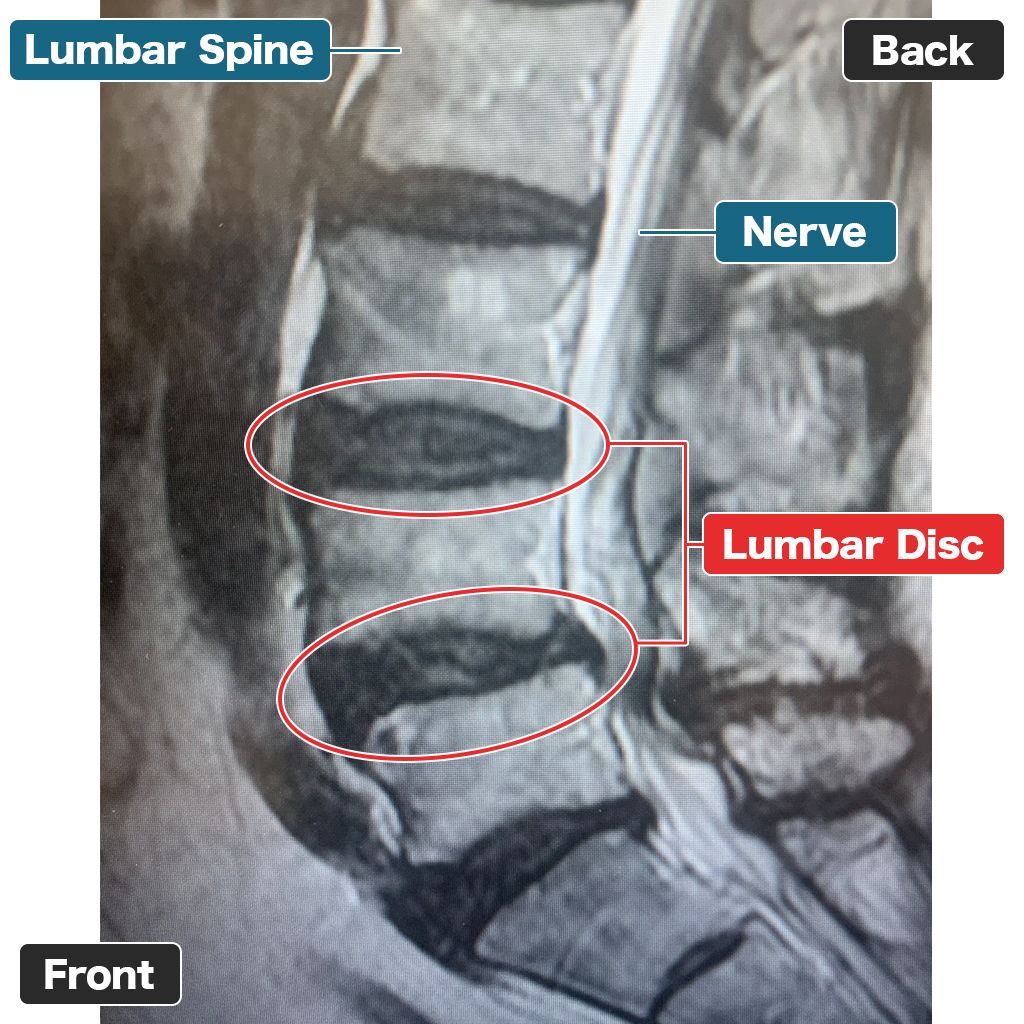 MRI Setelah Perawatan