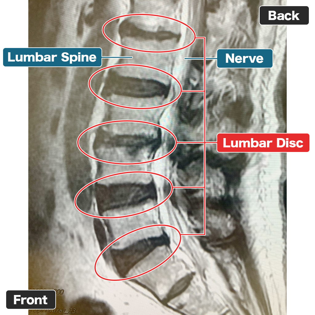 MRI sebelum perawatan