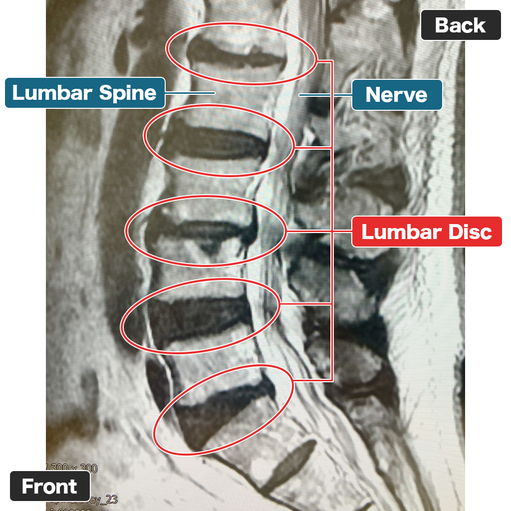 MRI setelah perawatan