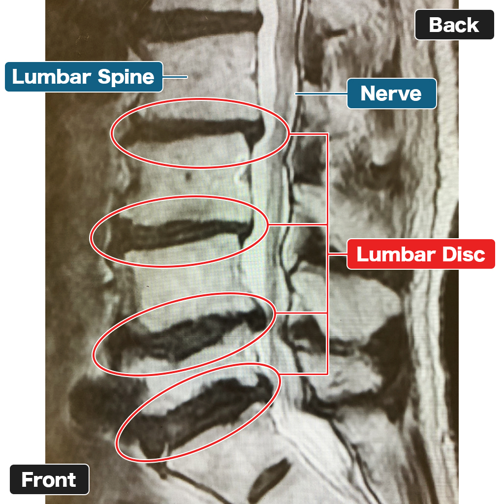 MRI sebelum perawatan