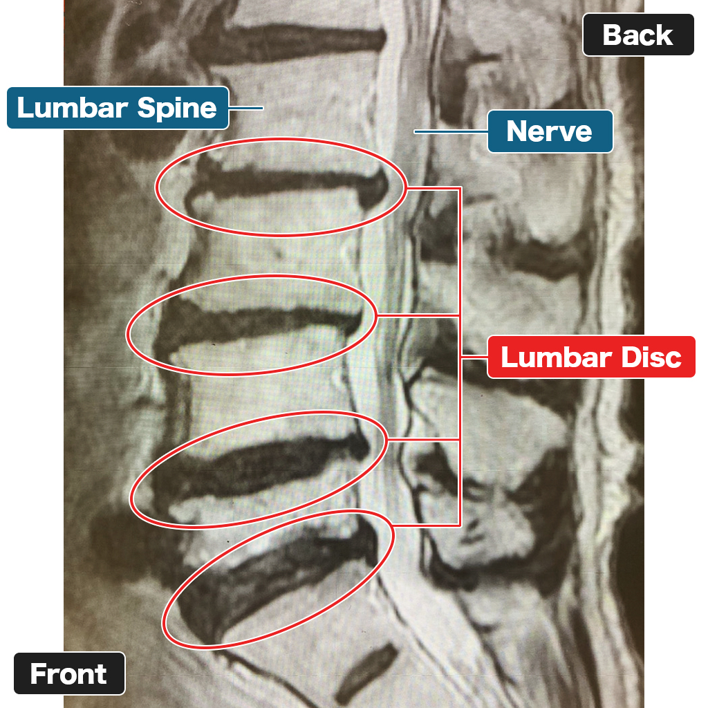 MRI setelah perawatan