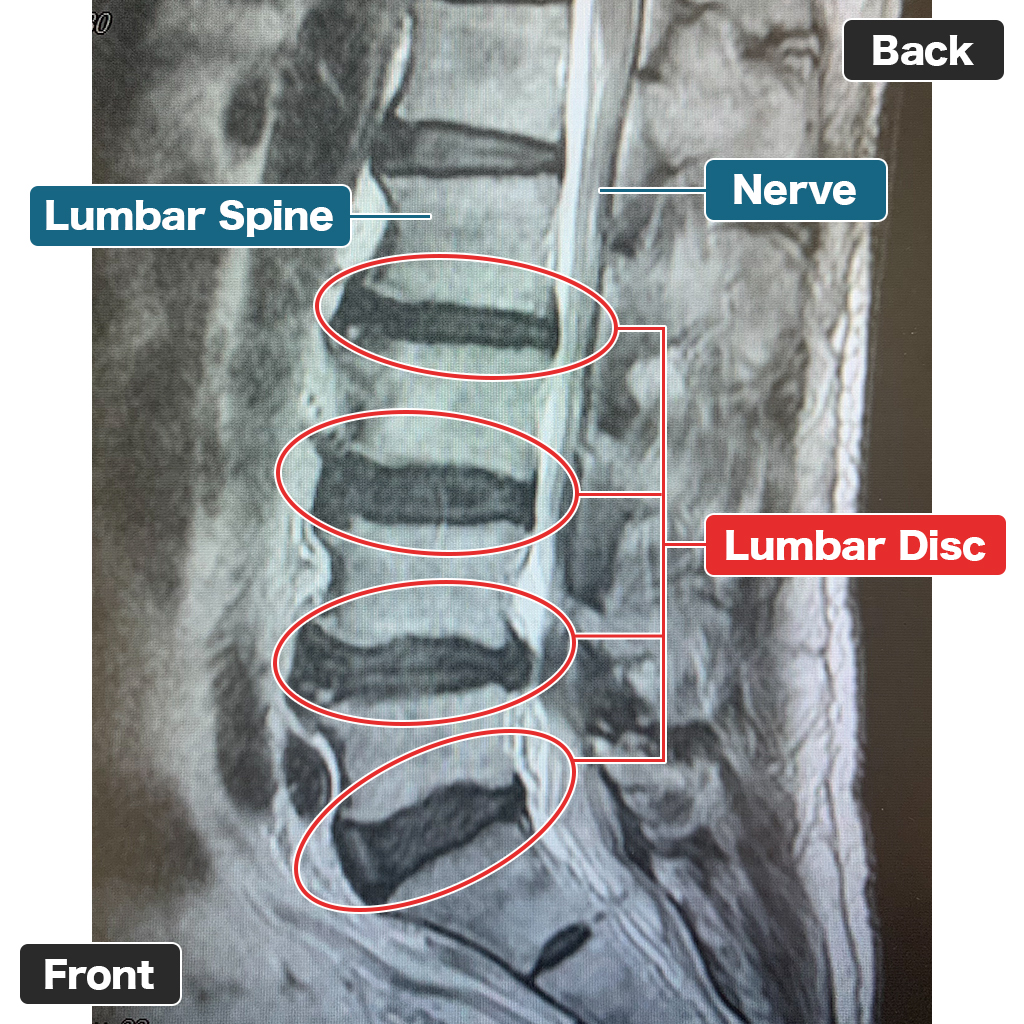 MRI sebelum perawatan