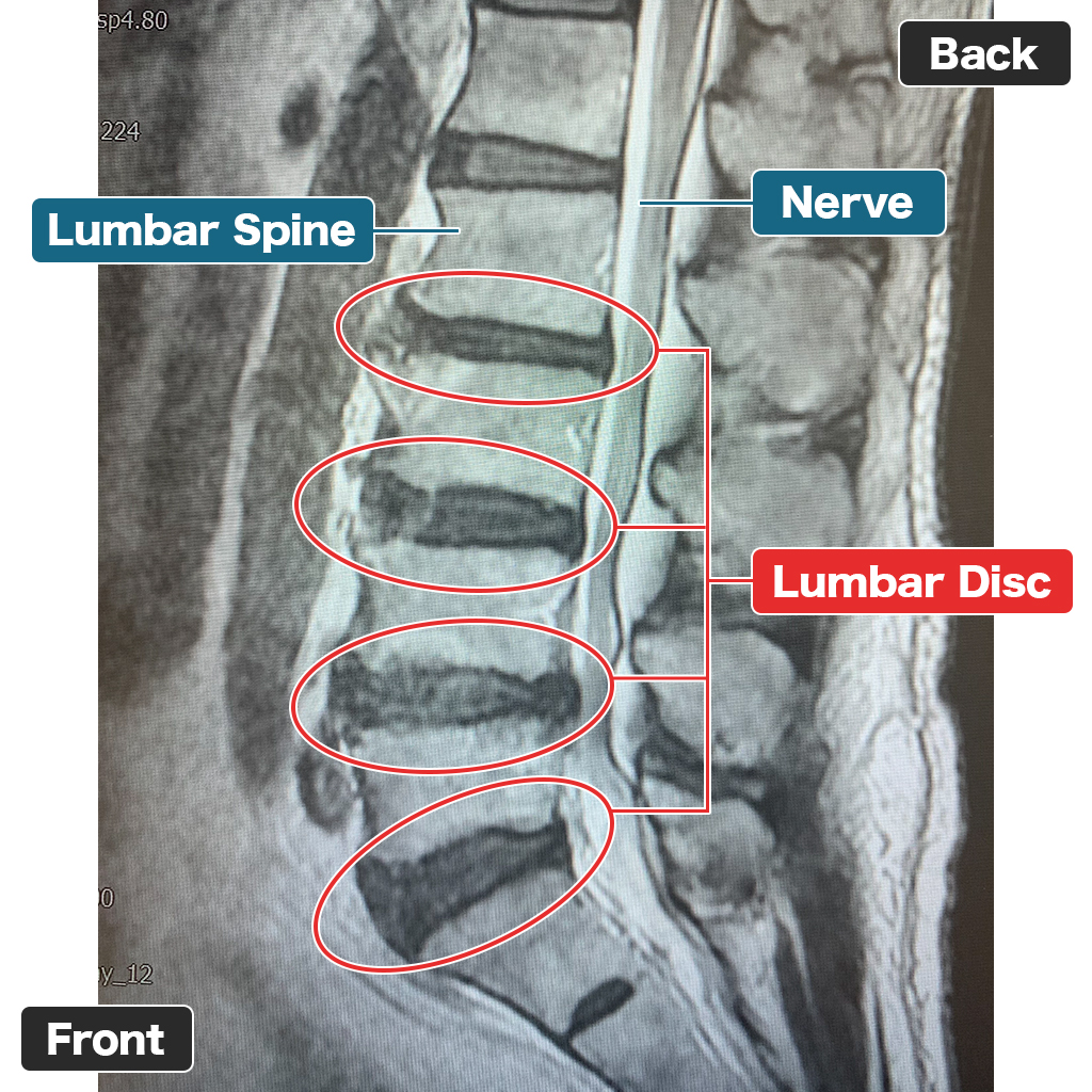 MRI setelah perawatan