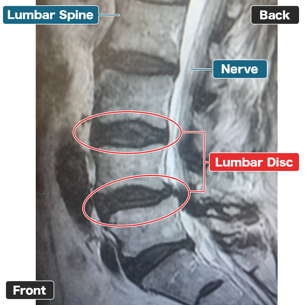 MRI Sebelum Perawatan