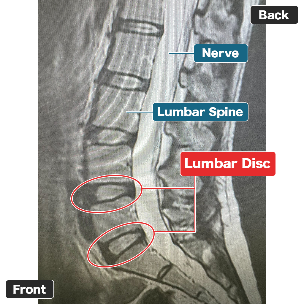 MRI