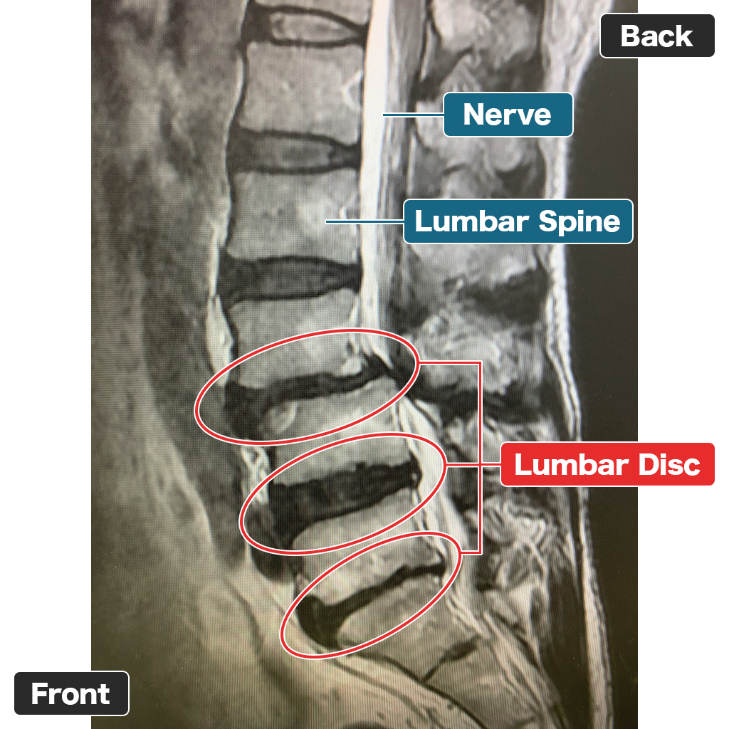 MRI