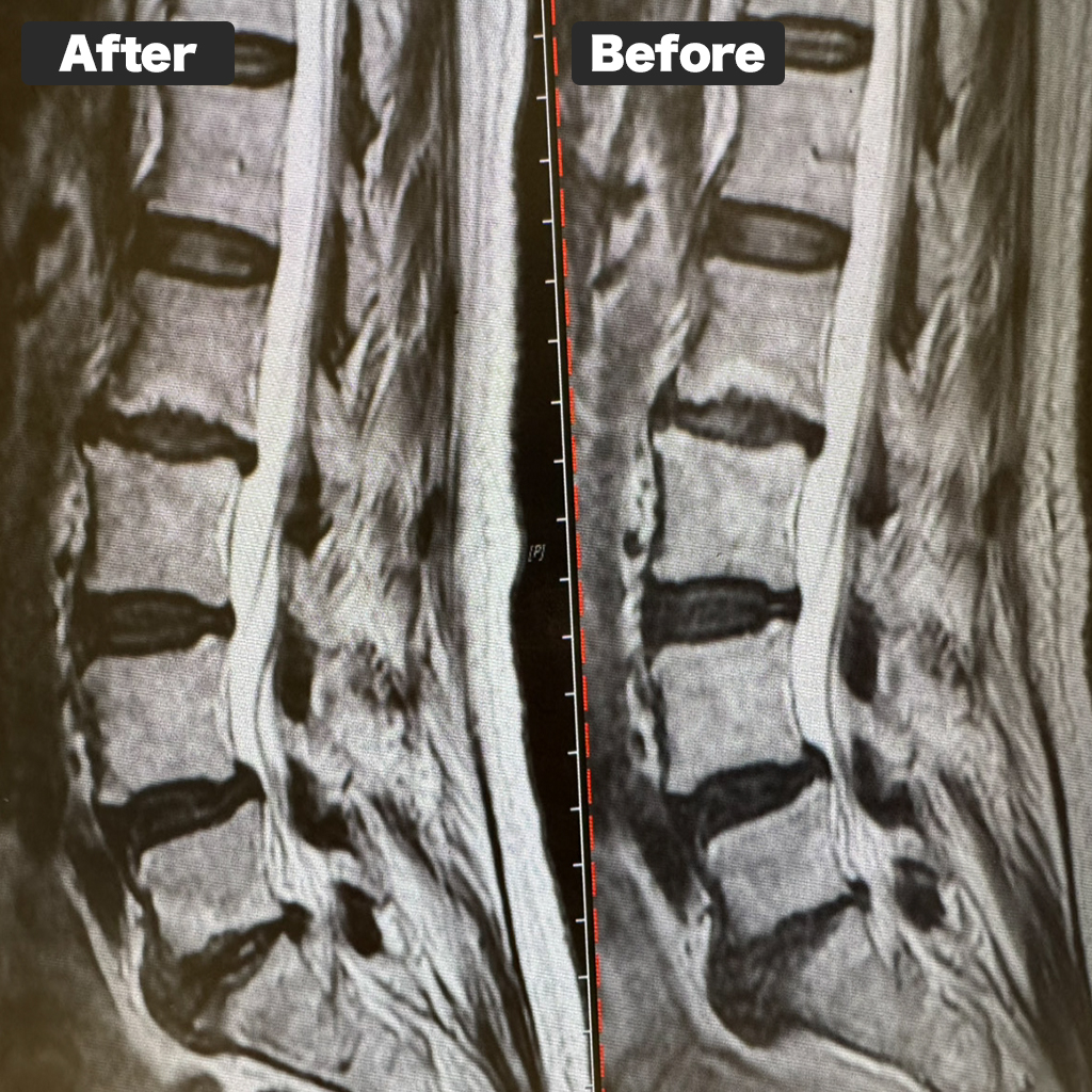 Foto MRI