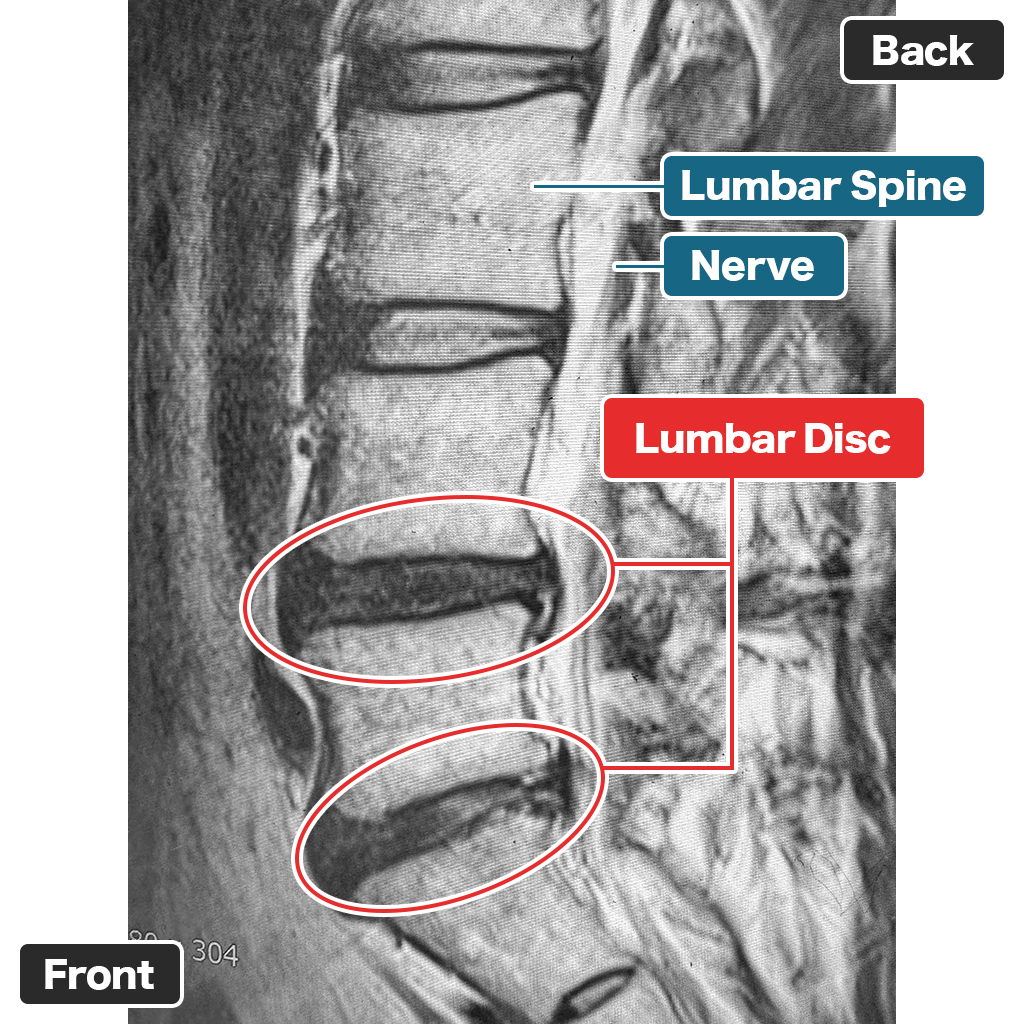 MRI Setelah Perawatan