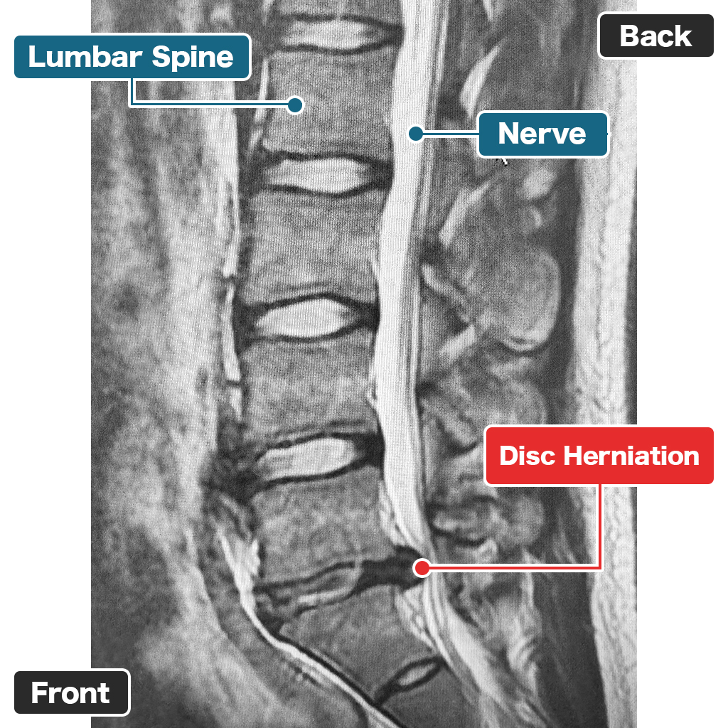 Pemeriksaan MRI